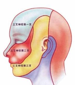 不同治疗三叉神经痛的方法适合哪些患者