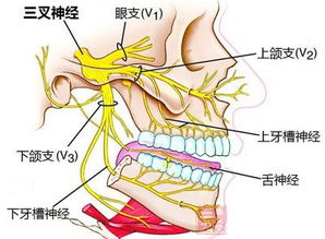 缓解三叉神经痛应该怎么做